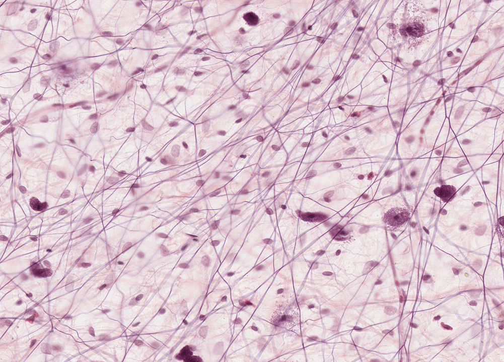 Areolar Connective Tissue Histology