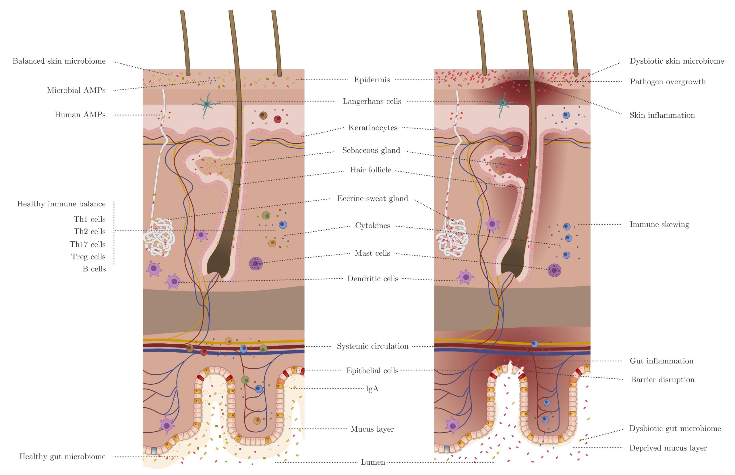 Microbiome and immune system connection between the skin and gut.