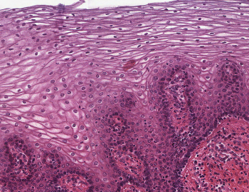 Epithelial tissues – Histology