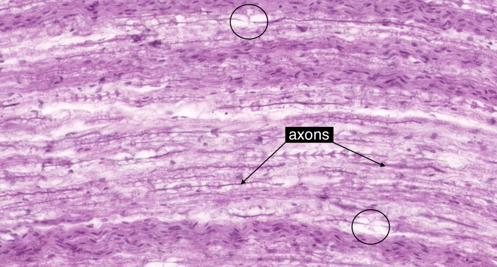 Optic Nerve Histology