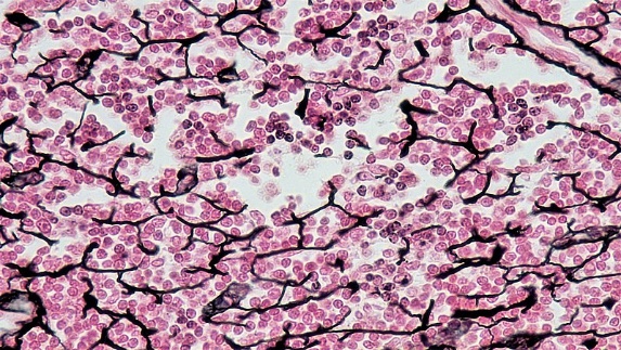 Reticular Tissue Histology