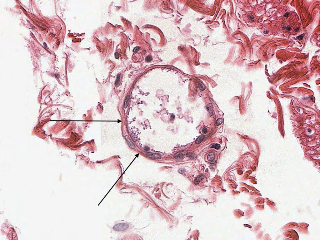 Histology Of Capillary