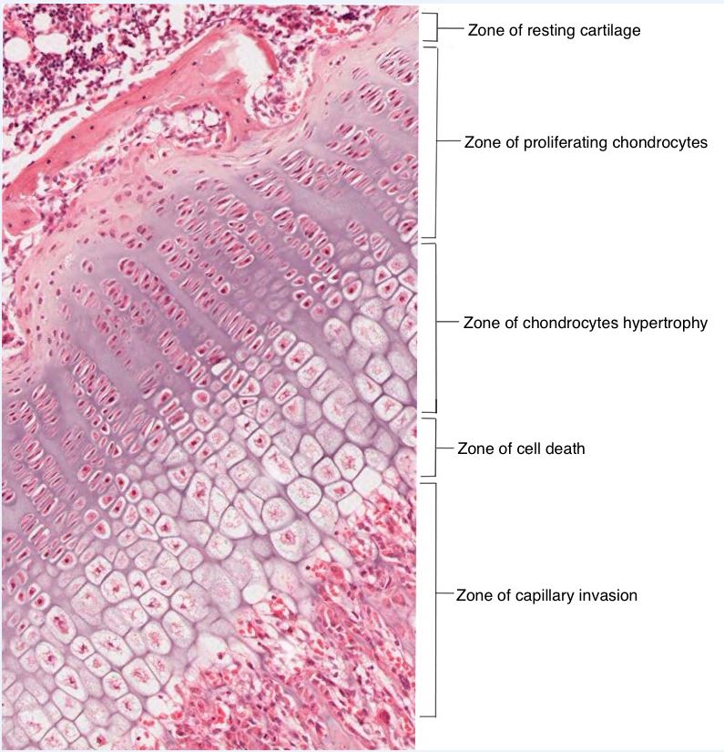 5 Zones Of Epiphyseal Plate