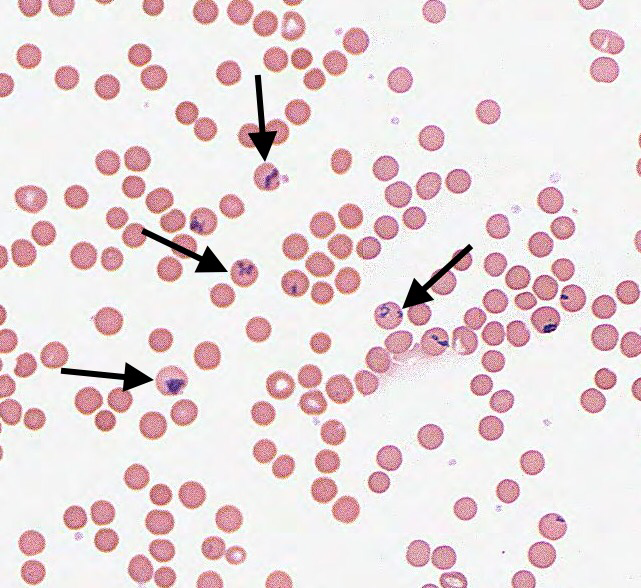 Ретикулоциты в мазке фото