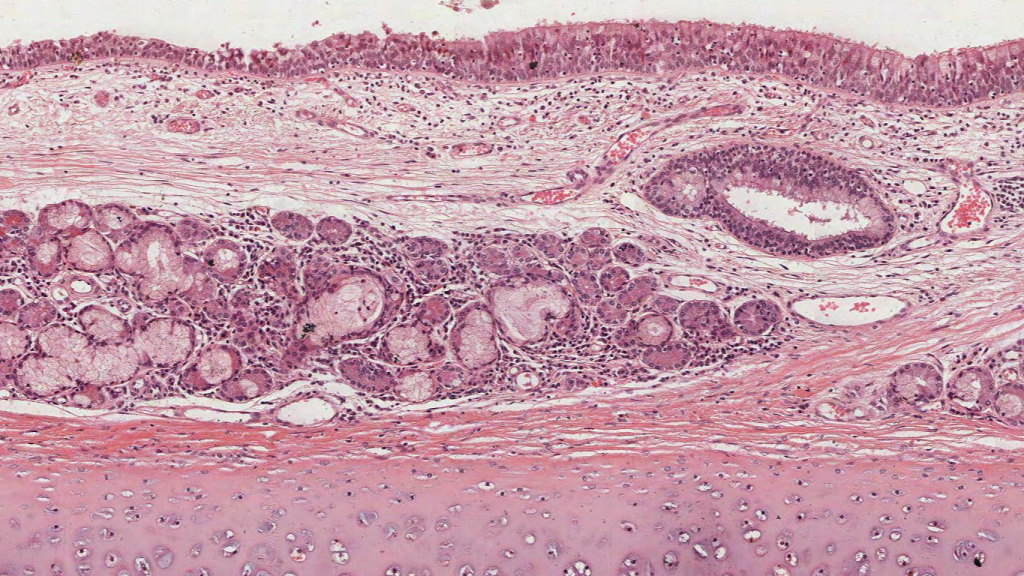 Bronchus Histology Labeled