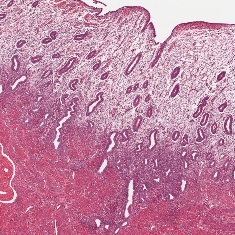 Histology Of The Human Endometrium During The Normal Cycle 