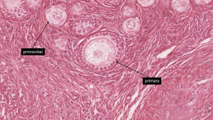 fallopian tube histology labeled