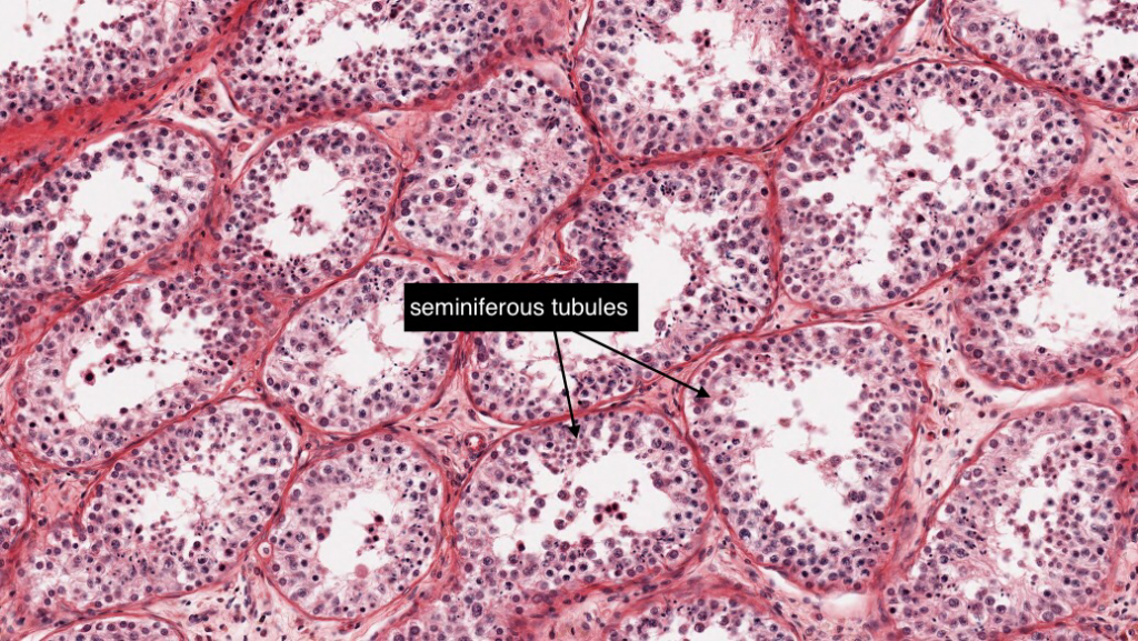 Testis Histology Slide Labeled