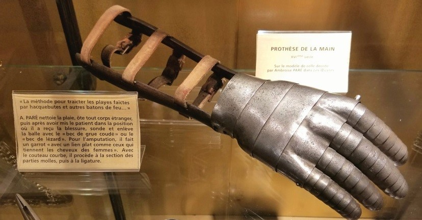 A metal prosthesis of a hand