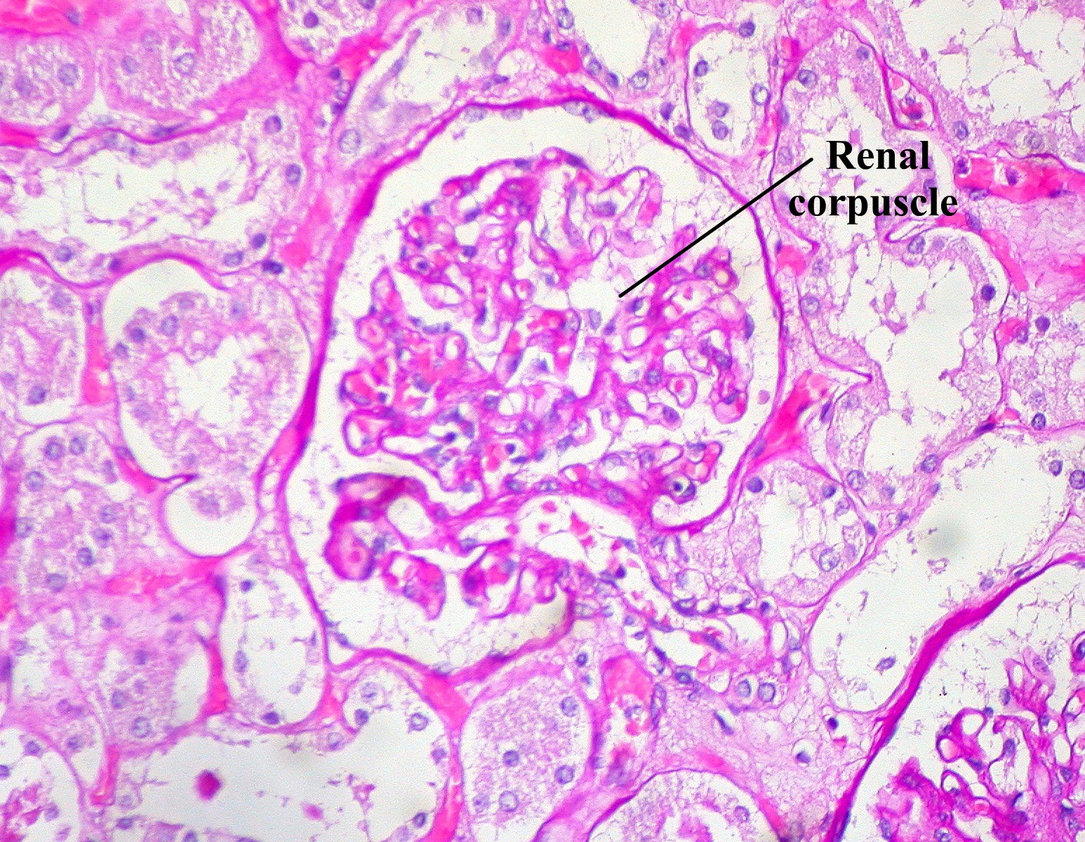 Structure - Renal corpuscle